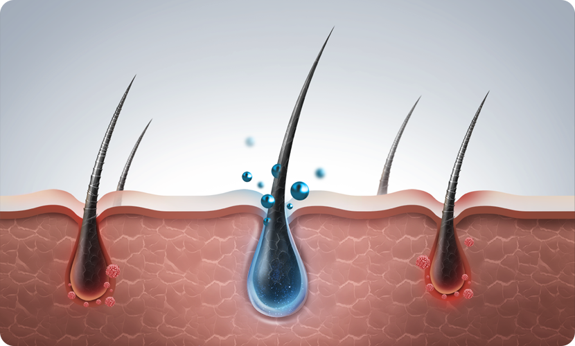 O2 Scalp Scaling