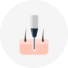 Follicle Separation