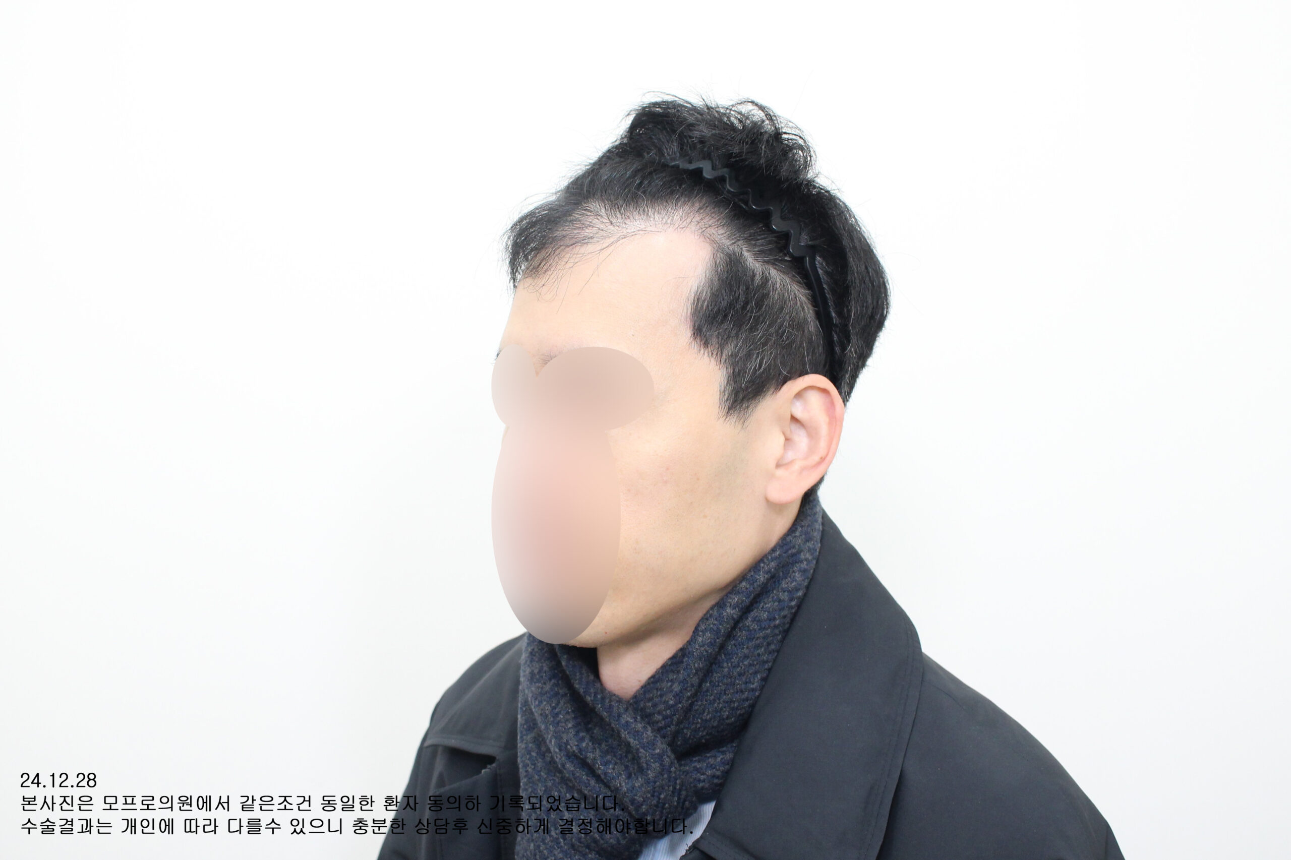 Before