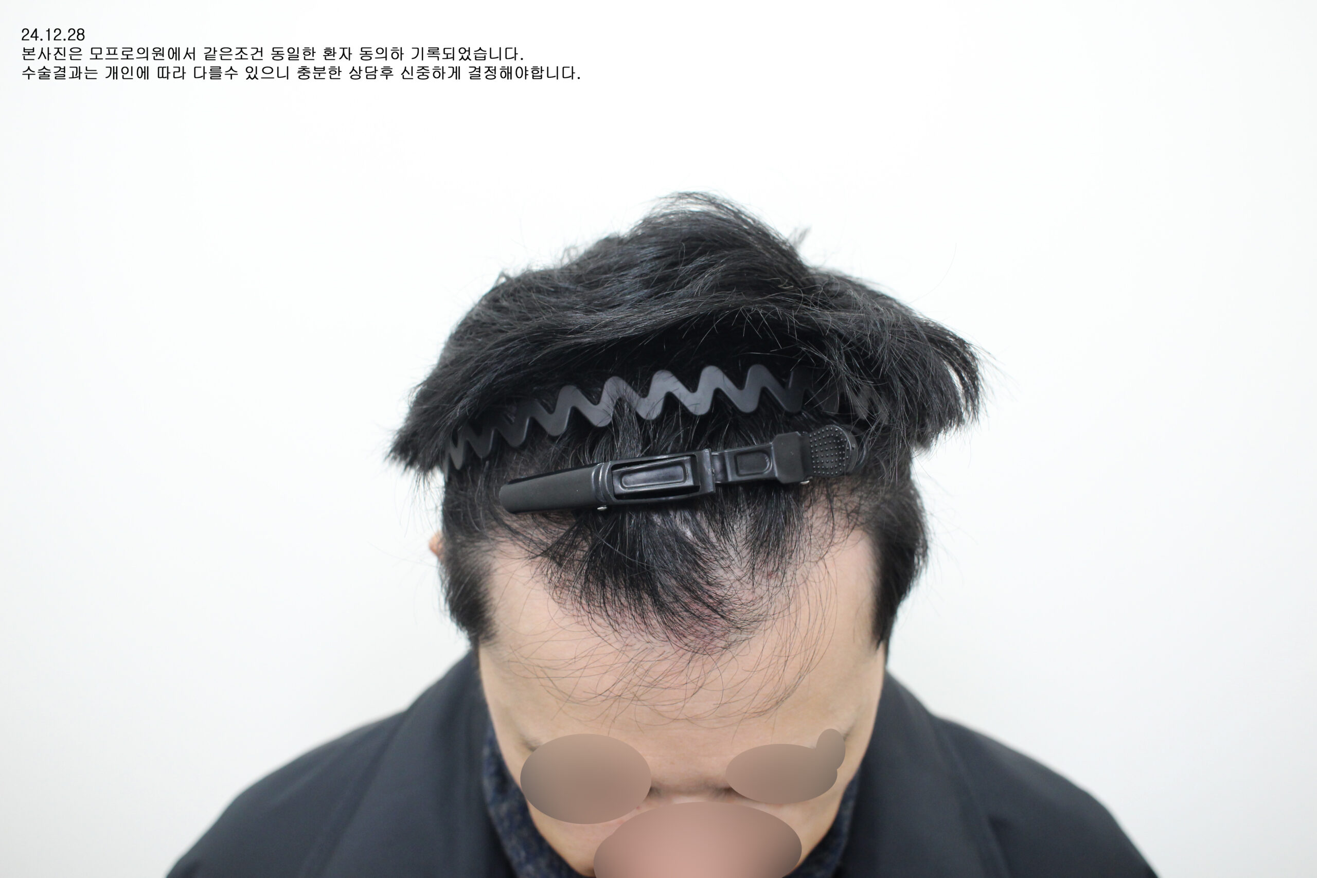Before