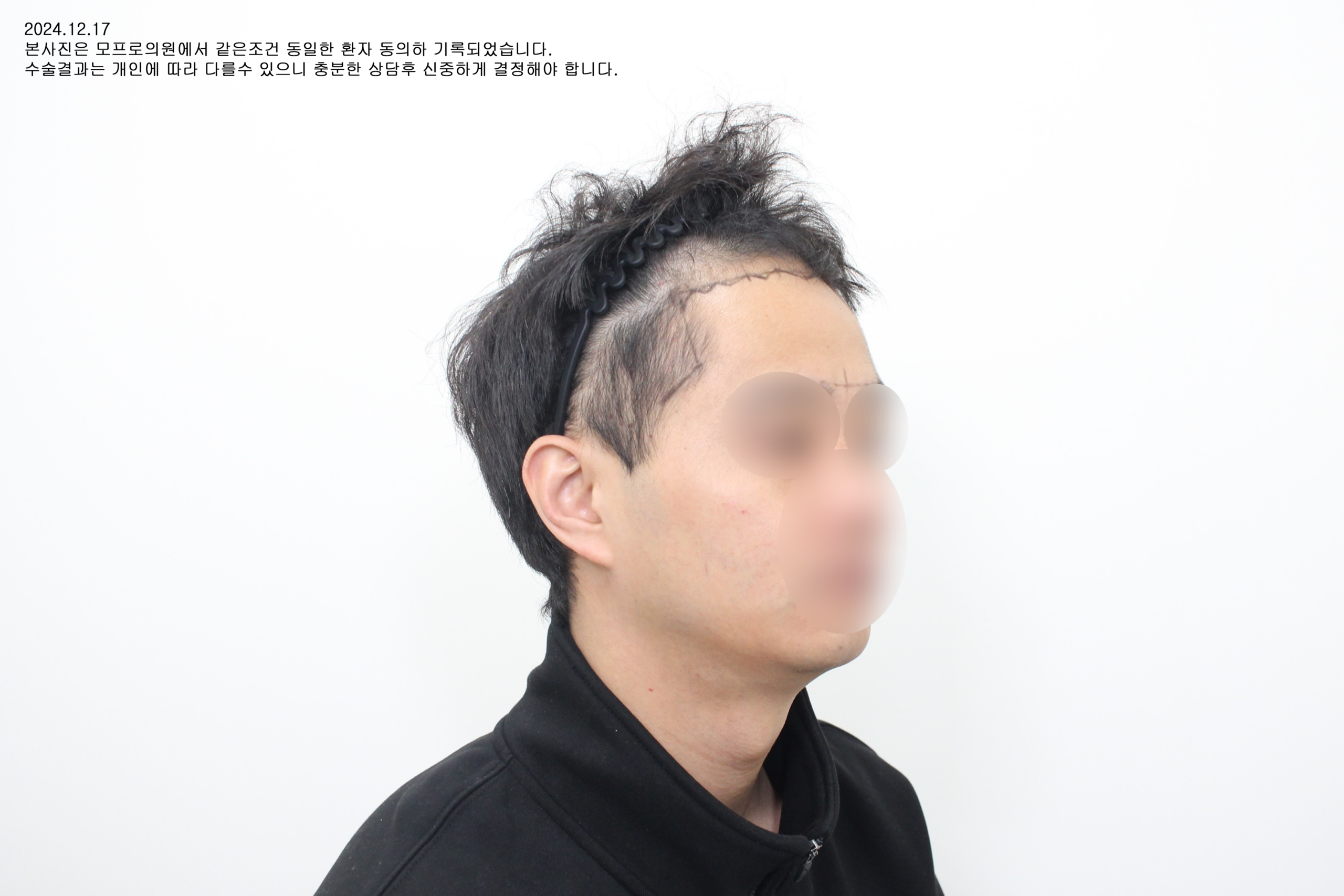 Before